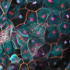 Hautzellen unter dem Mikroskop